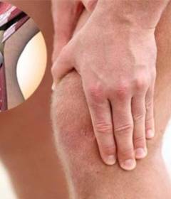 Артрит коленного сустава