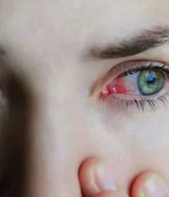 Что будет, если спать в линзах ночью	