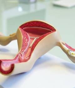 Гипоплазия матки 1 степени	