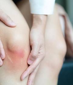 Как восстановить суставы после травмы