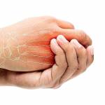  Лучшие способы лечения артрита народными средствами в домашних условиях 