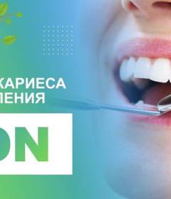 Лечение кариеса методом ICON