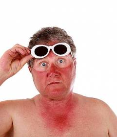 Народные средства от солнечных ожогов