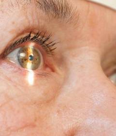 Первые симптомы катаракты