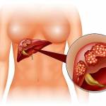  11 лучших продуктов полезных для печени 