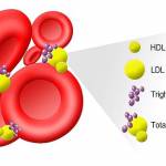  11 продуктов с самым высоким холестерином 