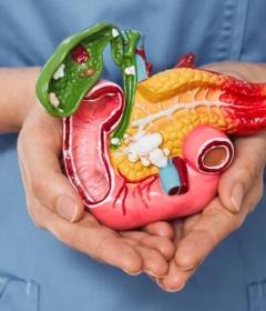 Рак поджелудочной железы