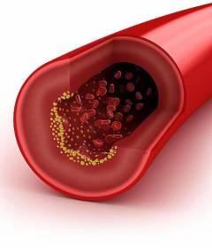 Продукты снижающие холестерин