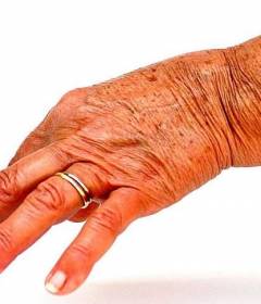 Травы при артрите