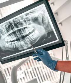 Цифровой рентген в стоматологии