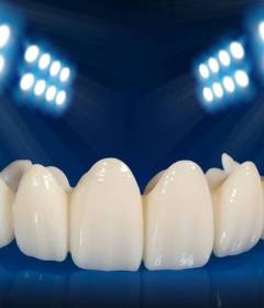 Всё, что нужно знать о зубных коронках