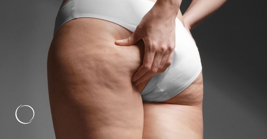 Миф №2: Это болезнь, которую нужно лечить