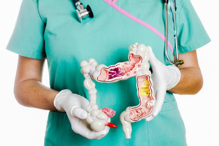 Диета после колоноскопии