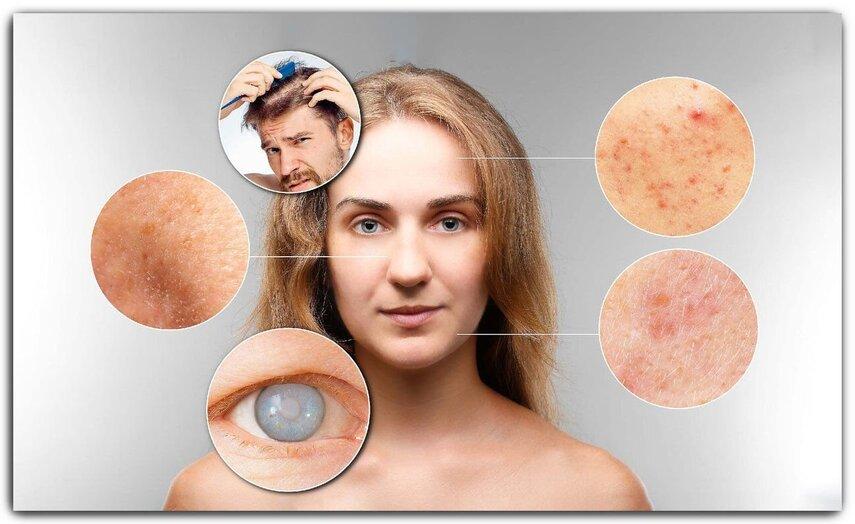 Недостаток биофлавоноидов и его последствия