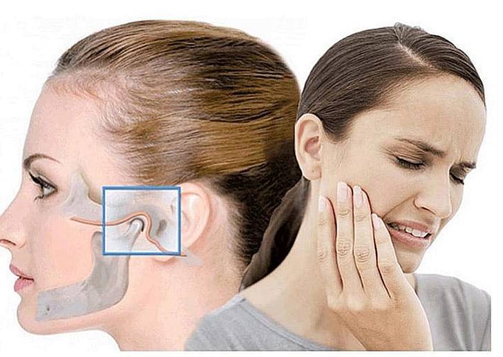 Нарушения височно-нижнечелюстного сустава