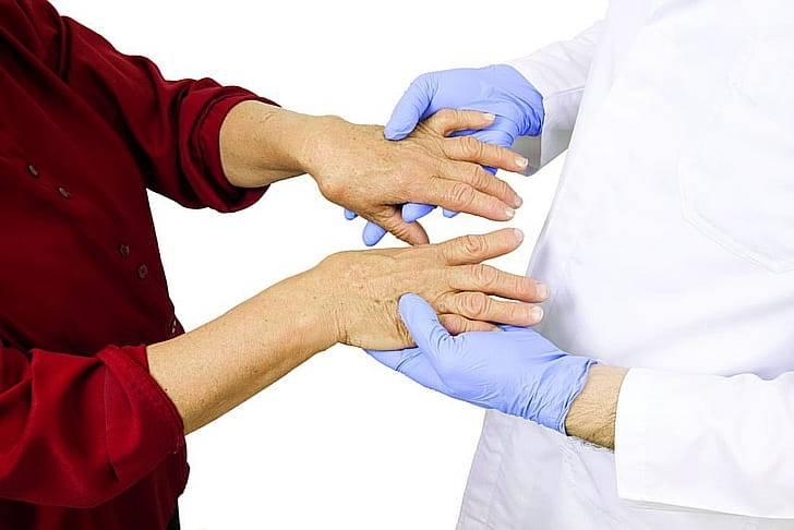 Помощь при ревматоидном артрите