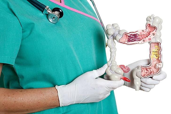 Борьба с воспалением кишечника