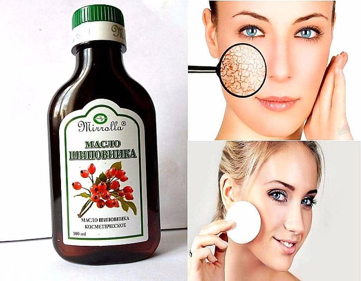 Шиповник для кожи щенщины