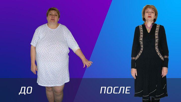 Жизнь после операции