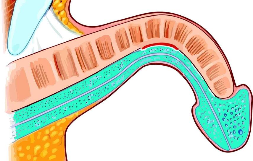 Что такое болезнь Пейрони? Полный разбор от врача-андролога