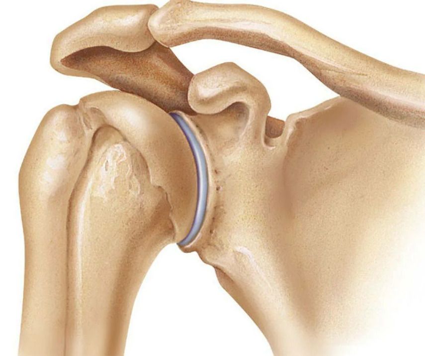 Анатомия плечевого сустава и причины его разрушения