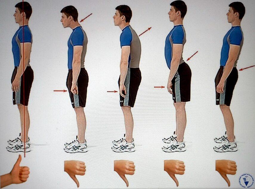 Мифы и заблуждения об осанке