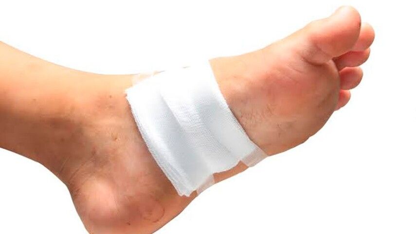 Как ускорить заживление раны на ноге: полное руководство от хирурга