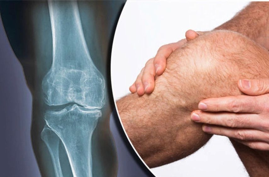 Профилактика: как сохранить суставы здоровыми после травмы?