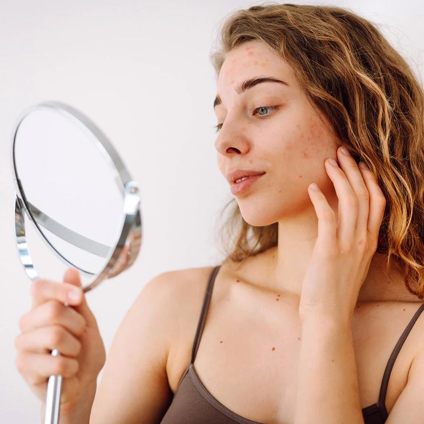 Симптомы и стадии: посмотрите в зеркало