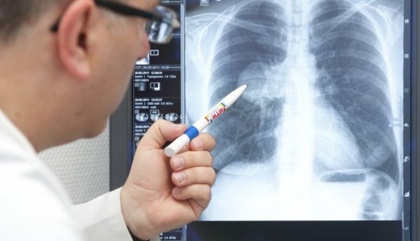 Что можно делать дома для облегчения состояния?