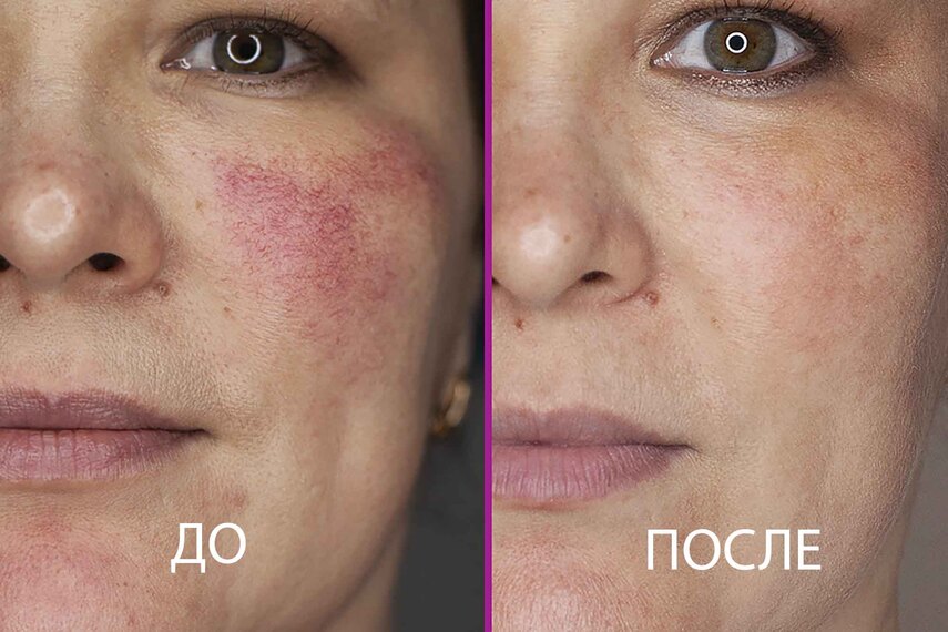 Инновационные методики