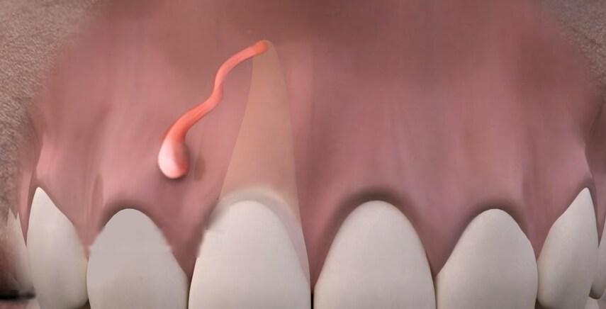 Флюс и другие заболевания