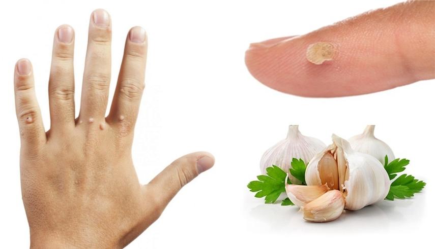 Народные средства как альтернатива