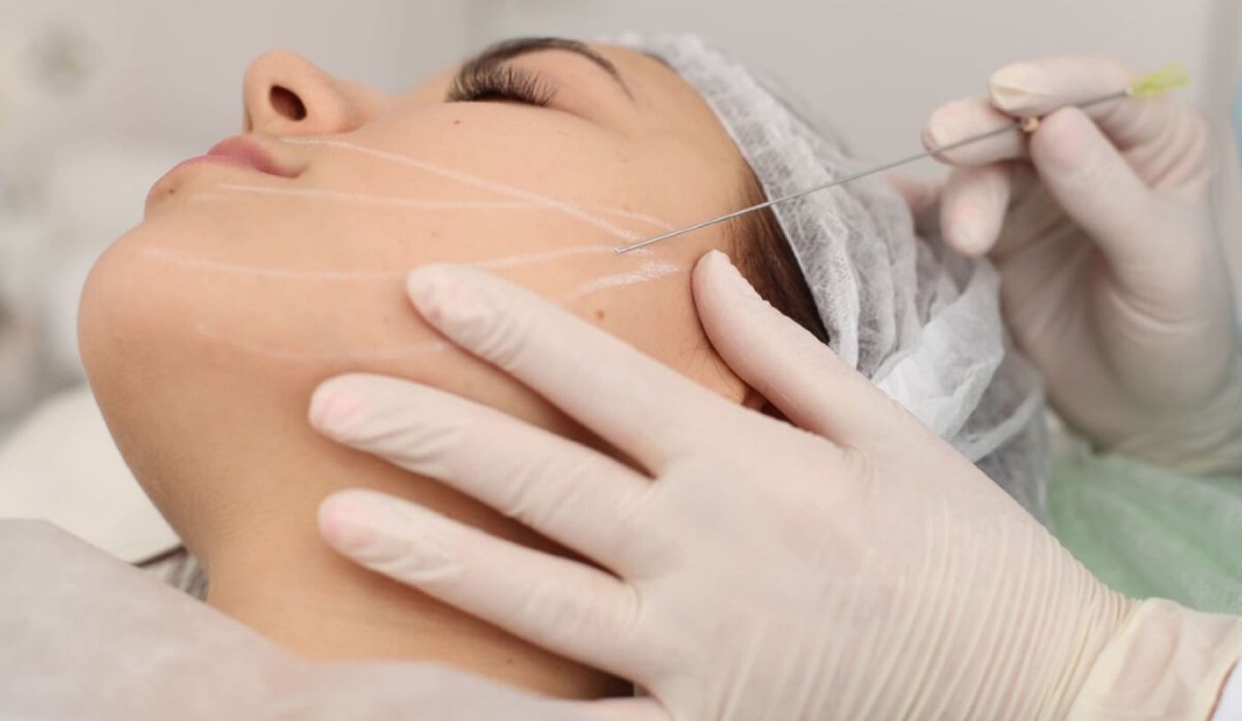 Нитевой лифтинг: все за и против процедуры