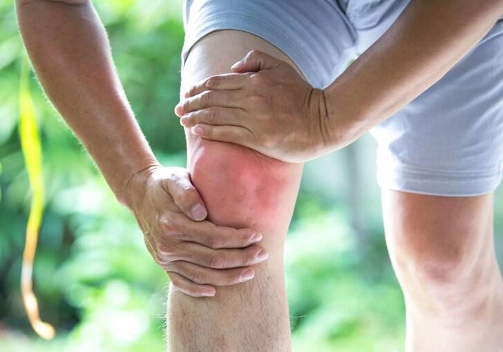 Клиническая картина остеоартроза коленного сустава