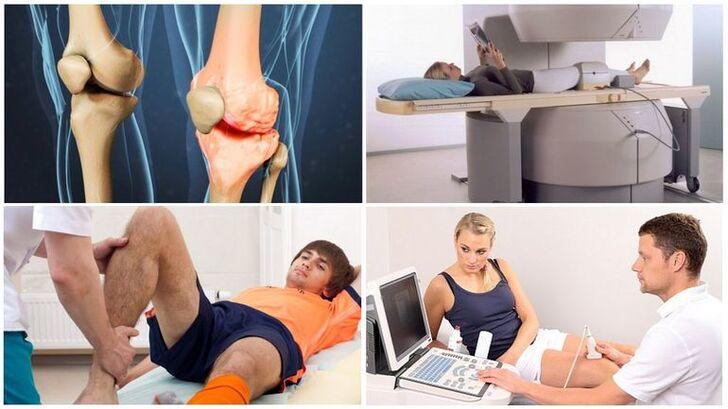 Диагностика остеоартроза коленного сустава