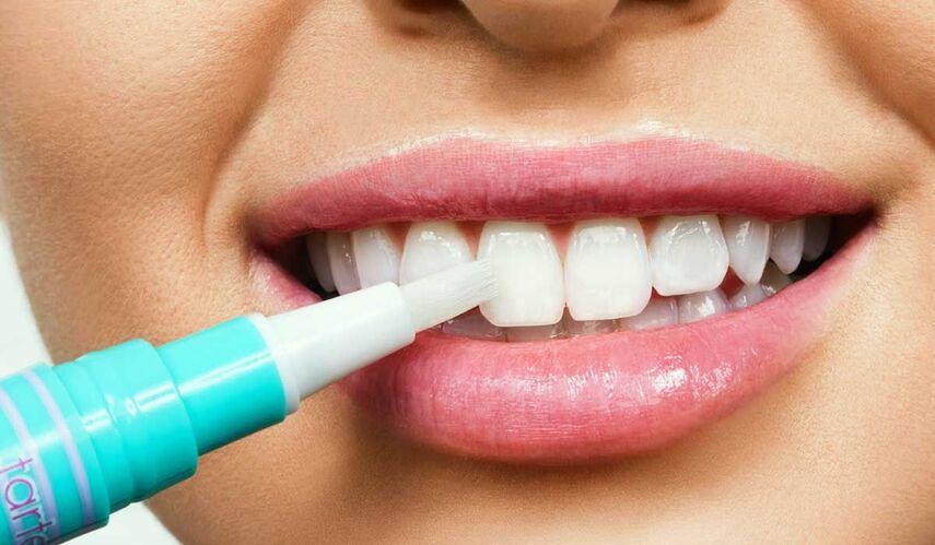 Домашнее отбеливание зубов от А до Я: минусы, плюсы и жизненные лайфхаки