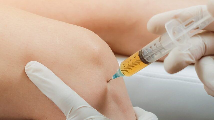 Плазмолифтинг коленного сустава: Эффективность, отзывы и рекомендации