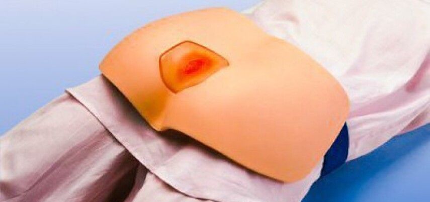 Профилактика – лучшая битва та, которой не было