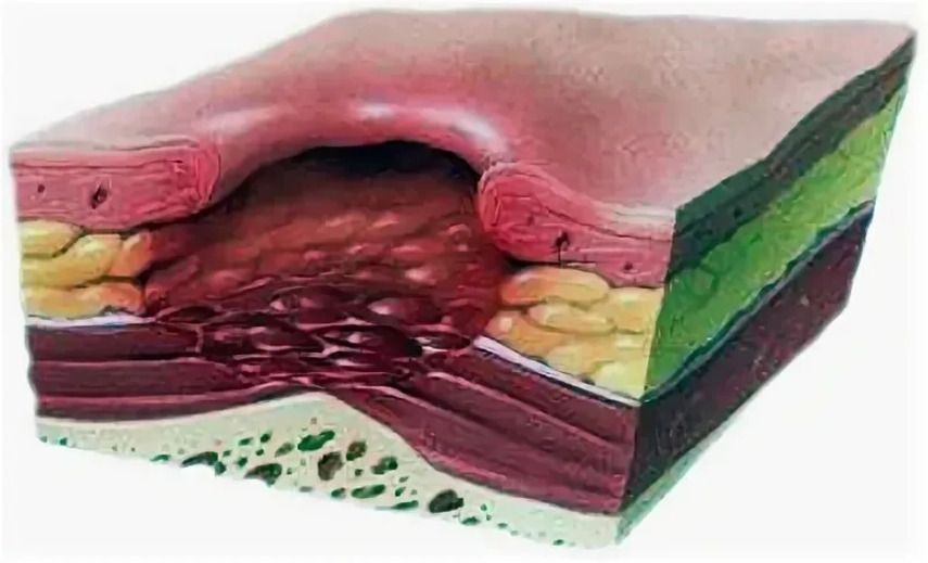 Сила природы: когда народные средства могут помочь, а когда – навредить?