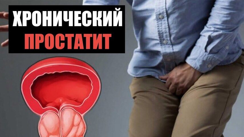 Симптомы простатита у мужчин: когда бить тревогу