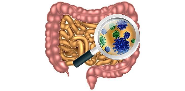 синдром дырявого кишечника