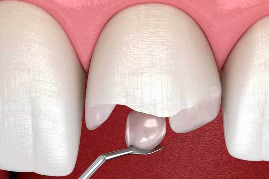 Современная реставрация зубов в городе Сургут: услуги стоматологии