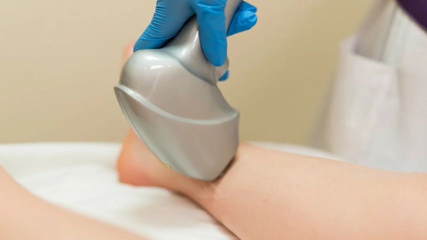 Как происходит лазерная операция?