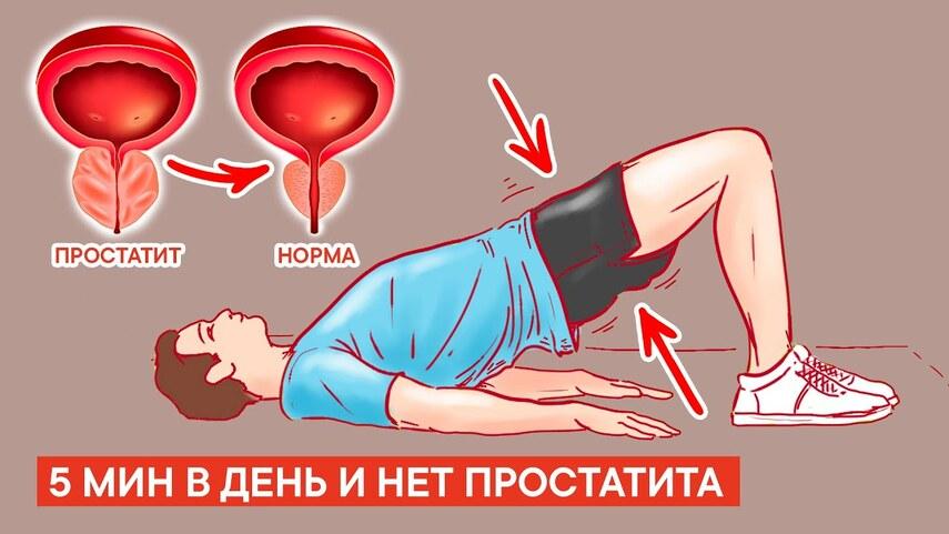 Лечебная физкультура