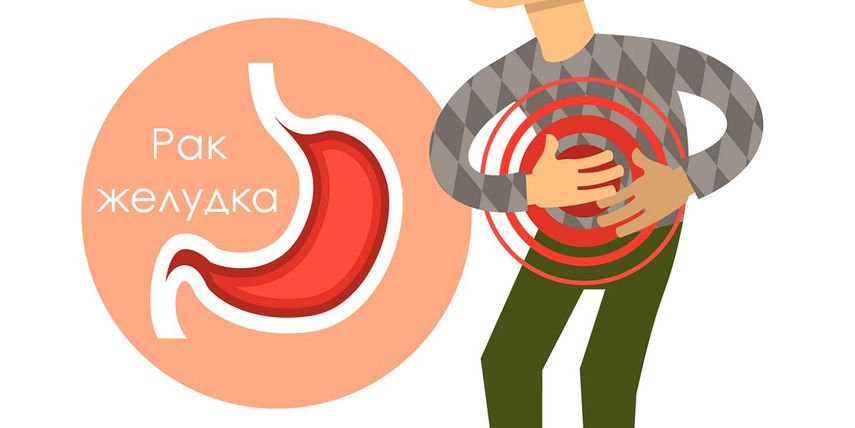 Методы лечения и прогноз выживаемости