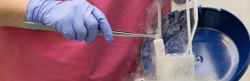 Процесс заморозки яйцеклетки