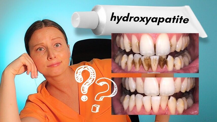 Гидроксиапатит или мел: кто заменяет фтор и как?